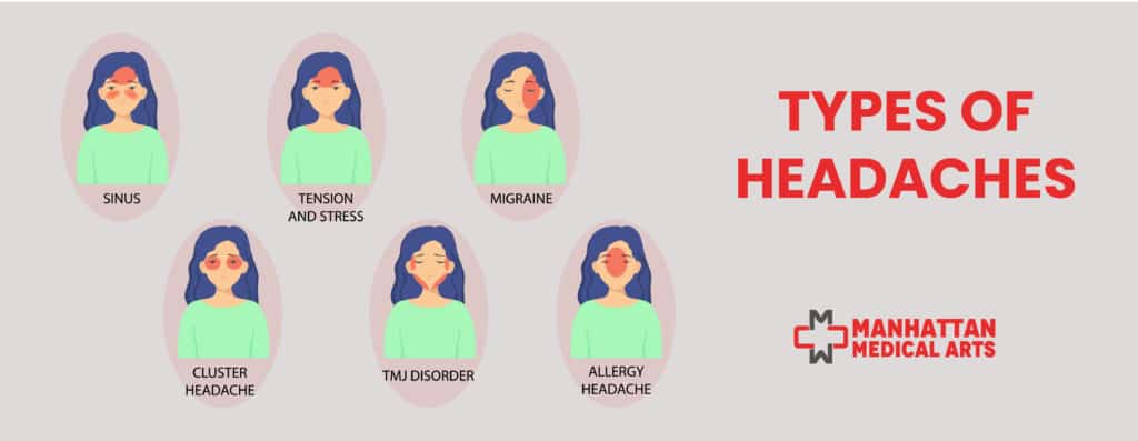 Types Of Headaches Locations Symptoms And Causes Manhattan Medical Arts