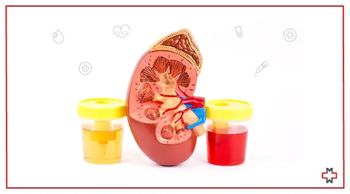 What Causes Small Blood Clots In Urine