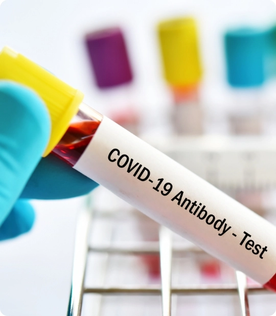 covid-19 antibody testing