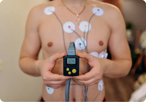 ECG Holter Monitoring For Comprehensive Heart Care