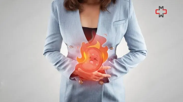 How To Stop Stomach Burning Immediately