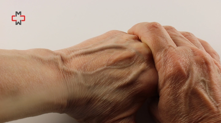 What Causes Veins To Be More Visible in Hands