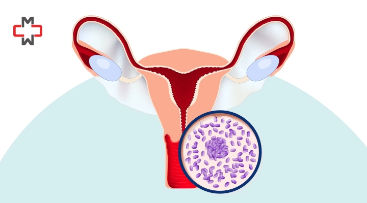 Mixed Urogenital Flora