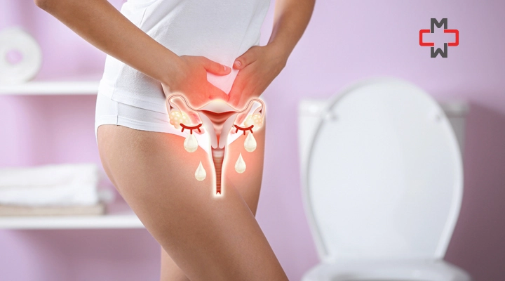 UTI vs Yeast Infection