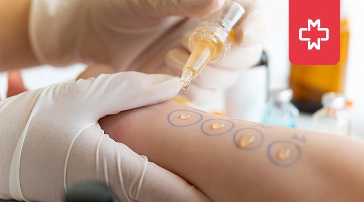 How Long Does an Allergy Test Take? (Complete Guide + Time Estimates)